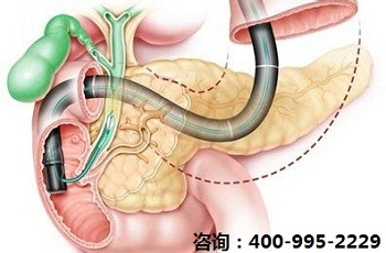 石家庄医高专附属第三医院特色介入治疗肿瘤